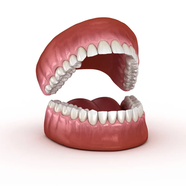 Dental Anatomy Opened Dentures Medically Accurate Dental Illustration — Stock Photo, Image