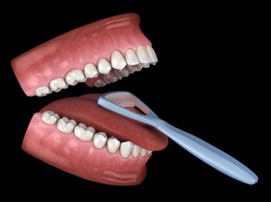 Dil temizliği - Kazıyıcı. Ağız hijyeni tıbbi olarak doğru 3d illüstrasyon.