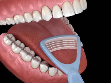 Dil temizliği - Kazıyıcı. Ağız hijyeni tıbbi olarak doğru 3d illüstrasyon.