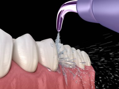 Tahriş edici, su dişleri temizliği. Ağız hijyeni tıbbi olarak doğru 3d illüstrasyon.