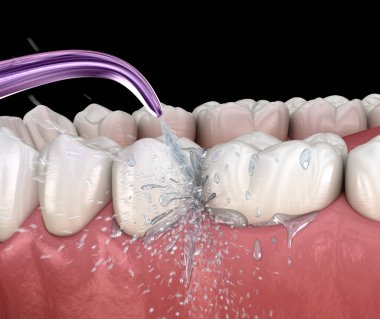 Tahriş edici, su dişleri temizliği. Ağız hijyeni tıbbi olarak doğru 3d illüstrasyon.