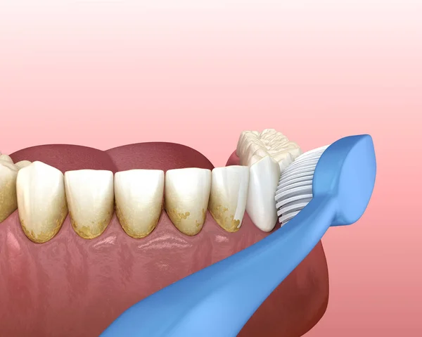 Tandborstens Tandborstning Medicinskt Korrekt Illustration Munhygien — Stockfoto