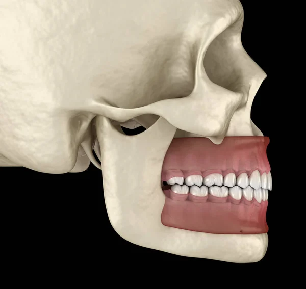 Dentes Humanos Saudáveis Com Oclusão Normal Ilustração Dente Medicamente Precisa — Fotografia de Stock