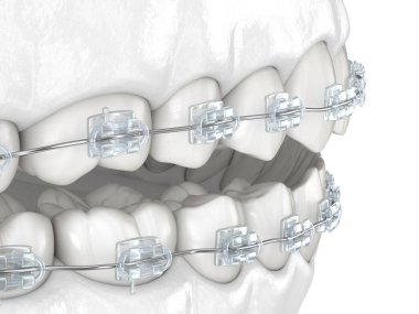 Dişler ve temiz diş telleri. Tıbbi olarak doğru olan 3 boyutlu diş illüstrasyonu