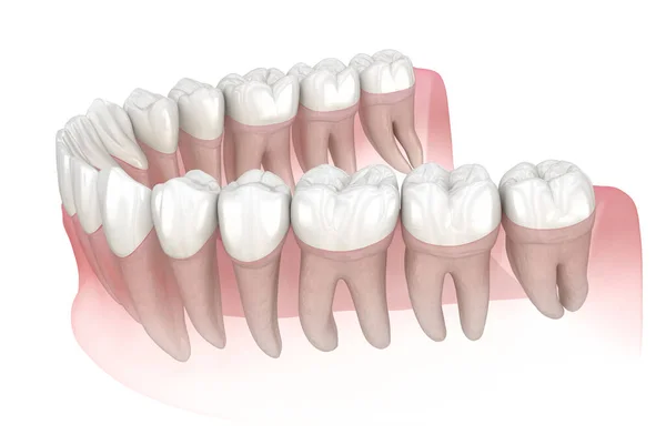 Gomme Denti Umani Mandibolari Illustrazione Del Dente Clinicamente Accurata — Foto Stock