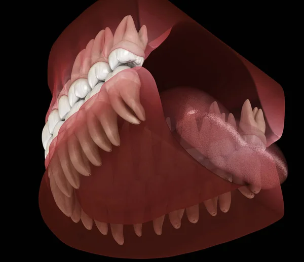 顎および上顎のヒトガムおよび歯の形態 医学的に正確な歯3Dイラスト — ストック写真