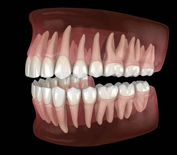 Morfologia Gengiva Dentes Humanos Inferiores Superiores Ilustração Dente Medicamente Precisa — Fotografia de Stock