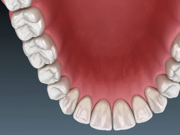 Gengiva Humana Maxilar Dentes Ilustração Dente Medicamente Precisa — Fotografia de Stock