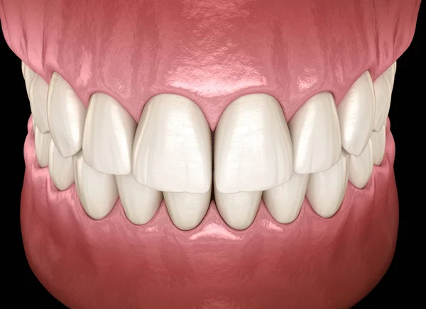 Dentes Humanos Saudáveis Com Oclusão Normal Visão Lateral Ilustração Dente — Fotografia de Stock