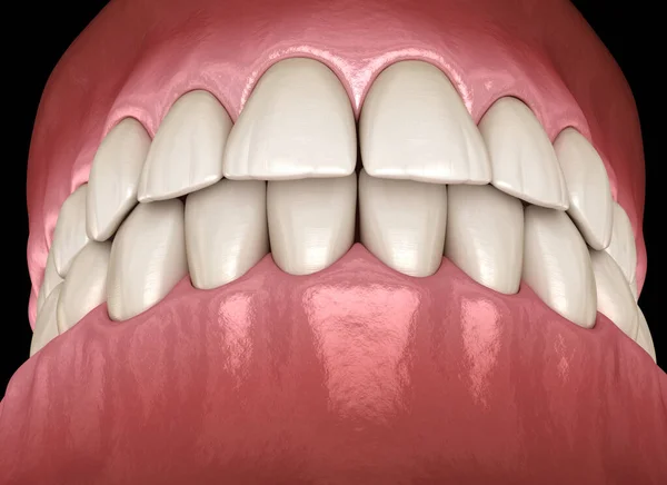 Zdrowe Ludzkie Zęby Prawidłowym Niedrożeniem Widok Boku Medycznie Dokładna Ilustracja — Zdjęcie stockowe