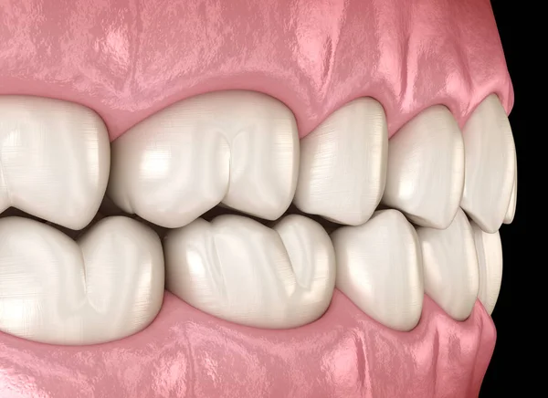 Dentes Humanos Saudáveis Com Oclusão Normal Visão Lateral Ilustração Dente — Fotografia de Stock