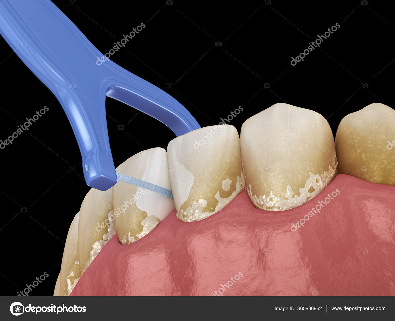 Oral Hygiene Using Toothpick Dental Floss Remove Food Stuck Teeth Stock