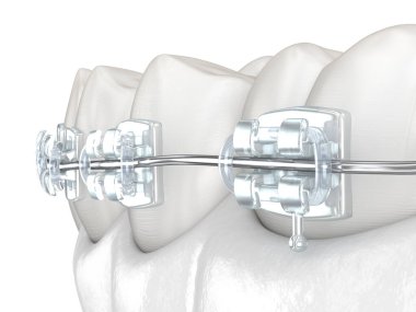 Dişler ve temiz diş telleri. Tıbbi olarak doğru olan 3 boyutlu diş illüstrasyonu