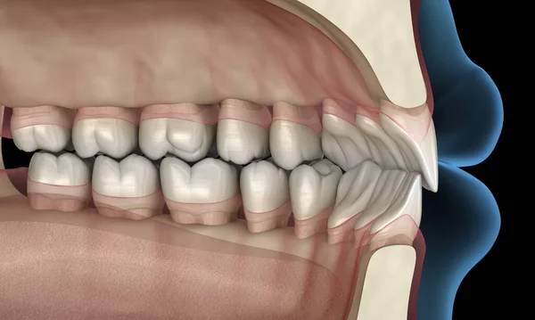 Normal Tıkanma Ile Sağlıklı Insan Dişleri Boyutlu Illüstrasyon — Stok fotoğraf