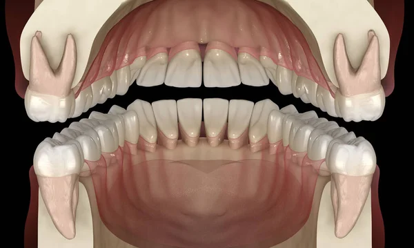 正常な閉塞を持つ健康な人間の歯 3Dイラスト — ストック写真