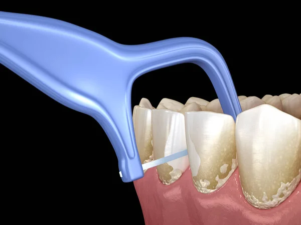 Munhygien Med Tandpetare Tandtråd För Att Bort Mat Fastnat Från — Stockfoto