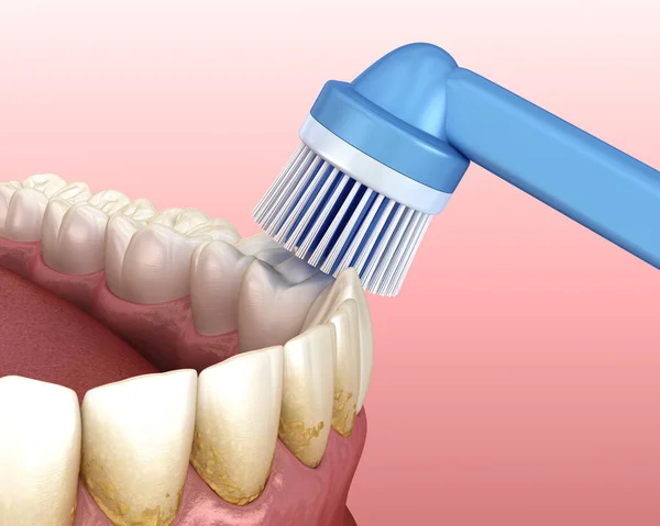 Elektrisk Tandborste Rengöring Tänder Isolerad Vitt Medicinskt Korrekt Illustration Munhygien — Stockfoto