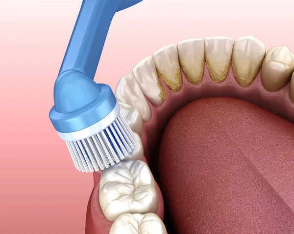 Elektrische Zahnbürste Zur Reinigung Der Zähne Isoliert Auf Weiß Medizinisch — Stockfoto