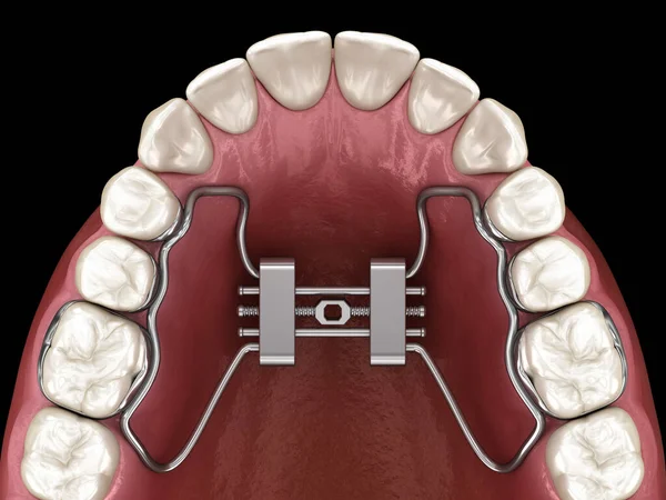出生前早期拡大 医学的に正確な歯3Dイラスト — ストック写真