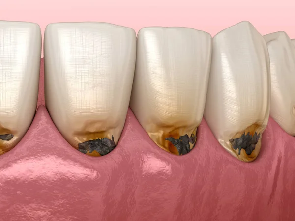 前頭葉に子宮頸部がある 医学的に正確な歯3Dイラスト — ストック写真