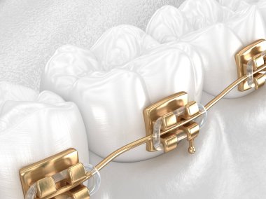 Altın diş telli sağlıklı dişler, beyaz diş konsepti, 3 boyutlu diş çizimi
