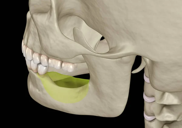 Mandíbula Mandibular Recesión Ósea Después Perder Los Dientes Molares Ilustración —  Fotos de Stock