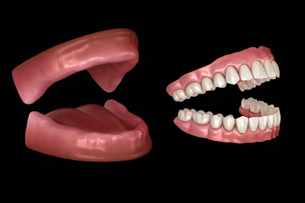 Prótesis Maxilar Mandibular Dentaduras Artificiales Ilustración Médicamente Precisa Dientes Humanos —  Fotos de Stock