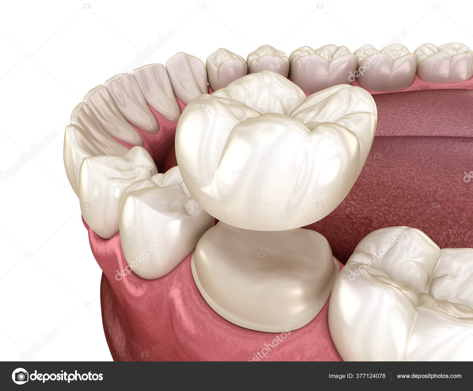 Зубы Готовые Купить
