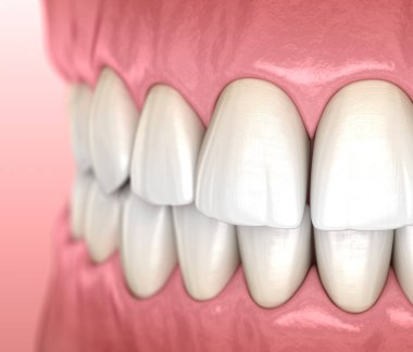 Sağlıklı insan sakızı ve diş anatomisi. Tıbbi olarak doğru diş 3D illüstrasyon