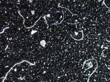 Bir aşırı closeup makro ayrıntı mikroskobik görüntü toz molekülleri, parçacıklar, dizeleri ve lifler bir siyah arka plan dokulu.