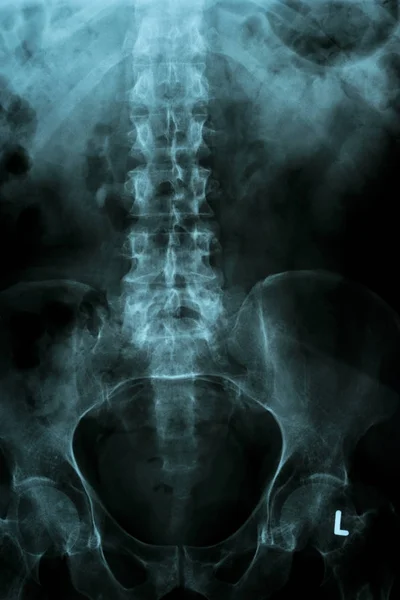 Coluna vertebral e pélvis de um corpo humano na imagem de raios-x — Fotografia de Stock