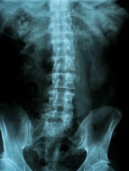 Image radiographique du bassin et de la colonne vertébrale — Photo