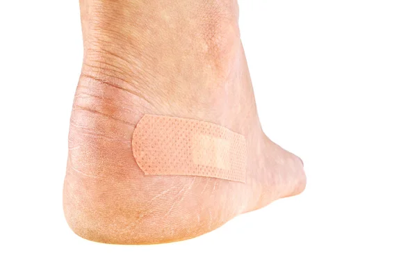 Closeup of woman's foot with adhesive plaster, Women's problems — Stock Photo, Image