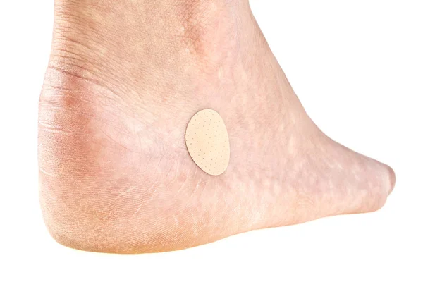 gros plan de lhomme de peau macro epidermis photo thinkstock points de suture apr 232 s l enl 232 vement de cancer de peau photographie jjvallee 169 11820652 gros plan de lhomme de peau macro epidermis photo thinkstock points de suture apr 232 s l enl 232 vement de cancer de peau photographie jjvallee 169 11820652