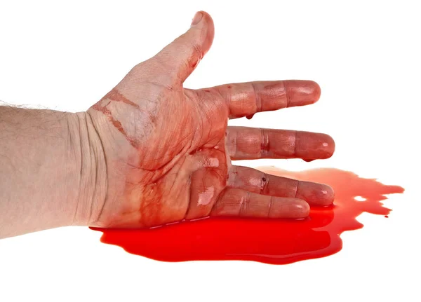 Mão no sangue em um fundo branco — Fotografia de Stock