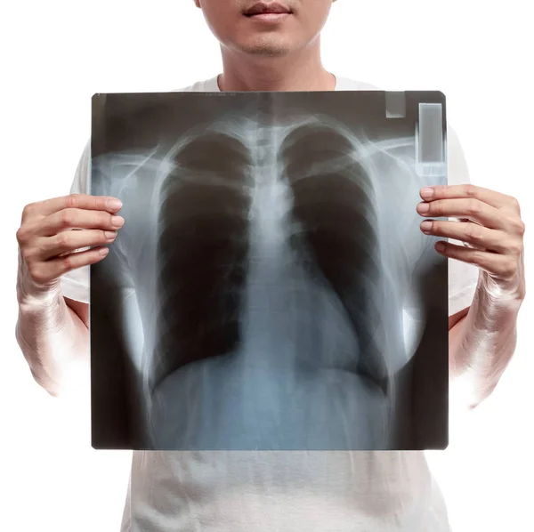 Asian man holding X-ray film, breast, vertebra scan. isolated on white — Stock Photo, Image