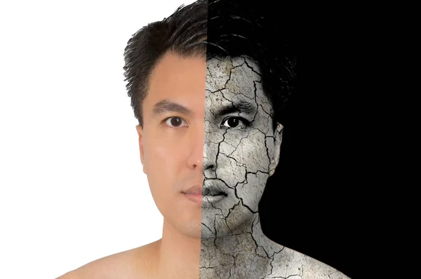 Homme asiatique visage sur une bonne peau saine et abîmée, peau sèche — Photo