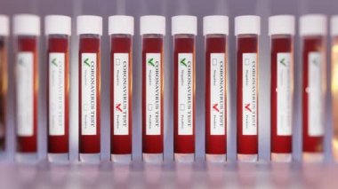 CORONAVIRUS testi yapılan test tüpleri. COVID-19. 3D 4K döngü canlandırması