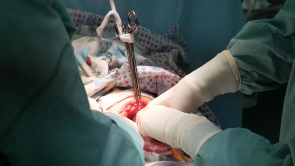 医院里进行外科手术的外科医生医疗队 — 图库视频影像
