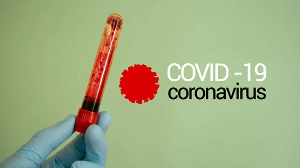 Conceito Coronavírus Covid Análises Sangue Fotografia De Stock