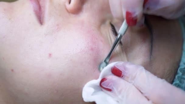 Mechanické čištění obličeje v salonu krásy — Stock video