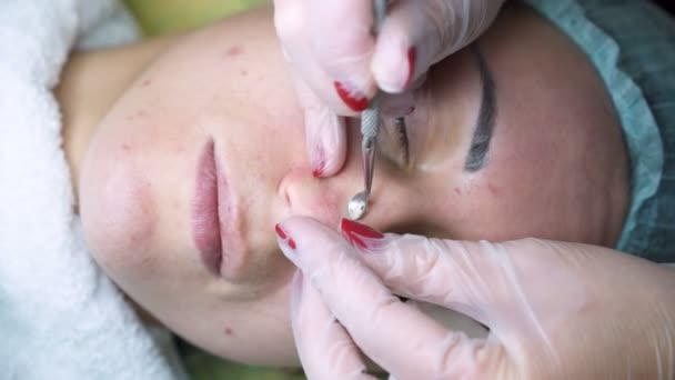 Limpeza facial mecânica no salão de beleza — Vídeo de Stock