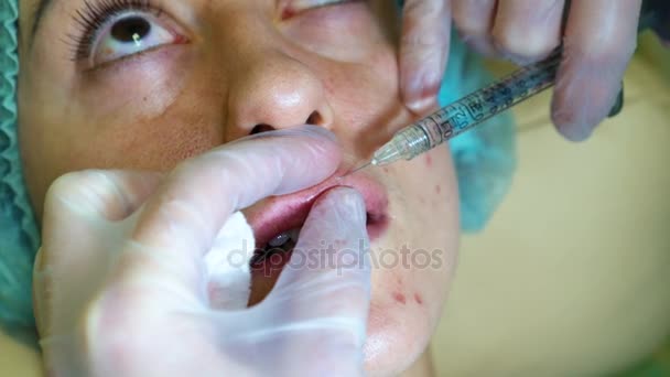 Красавчик делает инъекционные пластиковые губы. Молодая женщина с увеличением губ в клинике — стоковое видео