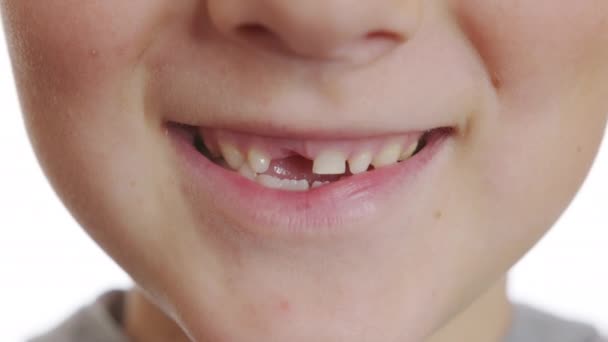 A fiú szája fogak nélkül. Baba fogak. Fogat váltok. Szájápolás. Közelkép, 6k. — Stock videók