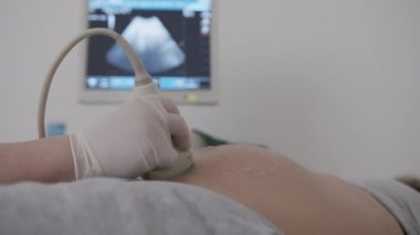 Doktor hamile bir kadına ultrason, ultrason ve sonogram prosedürü uyguluyor. - Yakın çekim. 6k.