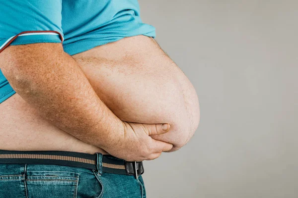 Nadváha lidského těla s rukama dotýkajícími se břicha. T — Stock fotografie