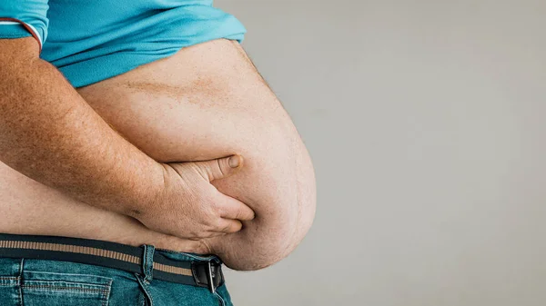 Surpoids du corps d'une personne avec les mains qui touchent l'abdomen. T — Photo