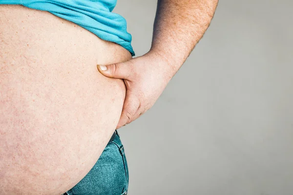 Nadváha Lidského Těla Rukama Dotýkajícími Břicha Koncept Obezity — Stock fotografie