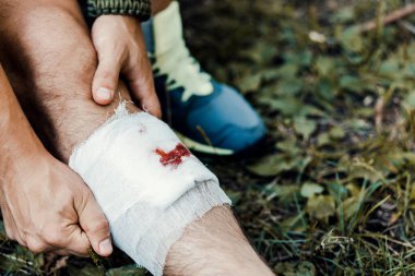 Genç bir adam, bir turist, bandajlı, kampa giderken bacağındaki yarayı sarar.