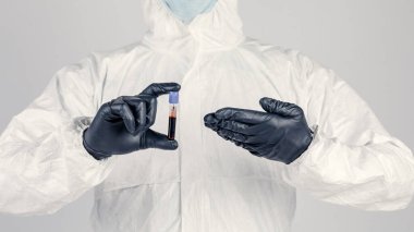 Bir adamın elinde test tüpü yakın plan, elinde kırmızı sıvı tutan tıbbi maskeli bir adam. Kan örnekleri, tıbbi ve kimyasal araştırmalar.
